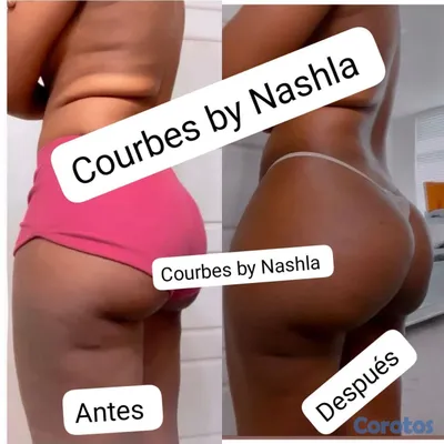salud y belleza - 

Dale volúmen a tus glúteos y senos
Escríbenos por WhatsApp.🍑 100% natural🌿 4