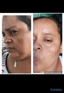 productos para el cuidado de la piel 