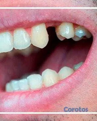 servicios profesionales - ESTUDIANTE DE TERMINO DE LA CARRERA DE ODONTOLOGIA 4