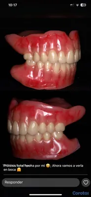joyas, relojes y accesorios - una pieza dental por tan solo 2mil peso y te la hago el mismo día  8