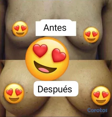 salud y belleza - 

Dale volúmen a tus glúteos y senos
Escríbenos por WhatsApp.🍑 100% natural🌿 20