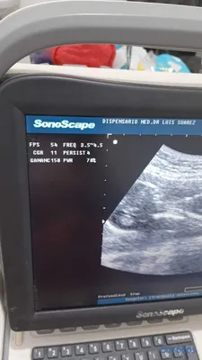 Salud y Equipamiento Médico - Sonógrafo Portátil + 3 Transductores + Carro + Imp. 5