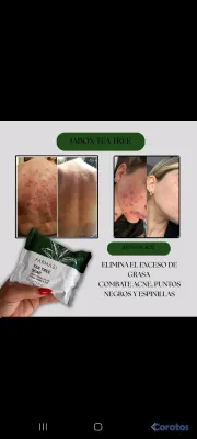 salud y belleza - jabones turcos  vaganos libre de paravenos y metales pesados  7