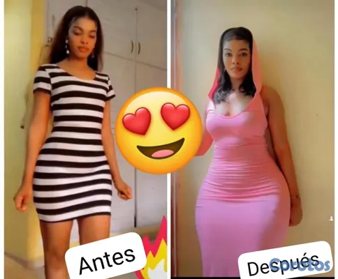 salud y belleza - 

Dale volúmen a tus glúteos y senos
Escríbenos por WhatsApp.🍑 100% natural🌿 6