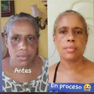 productos para el cuidado de la piel 