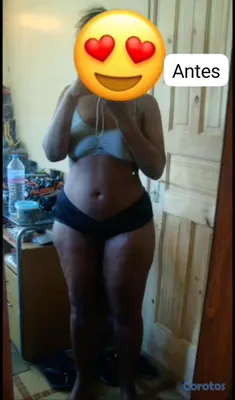salud y belleza - 

Dale volúmen a tus glúteos y senos
Escríbenos por WhatsApp.🍑 100% natural🌿 7