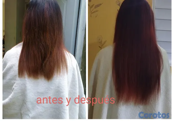 salud y belleza - Gotero anticaida y crecimiento  3