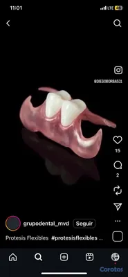 joyas, relojes y accesorios - una pieza dental por tan solo 2mil peso y te la hago el mismo día  7