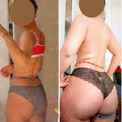 salud y belleza - 

Dale volúmen a tus glúteos y senos
Escríbenos por WhatsApp.🍑 100% natural🌿 15