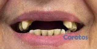 servicios profesionales - ESTUDIANTE DE TERMINO DE LA CARRERA DE ODONTOLOGIA 2