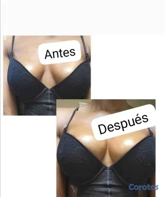salud y belleza - 

Dale volúmen a tus glúteos y senos
Escríbenos por WhatsApp.🍑 100% natural🌿 18