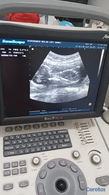Salud y Equipamiento Médico - Sonógrafo Portátil + 3 Transductores + Carro + Imp. 6