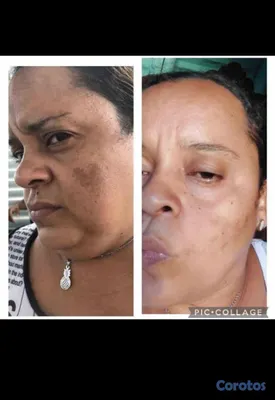 salud y belleza - productos para el cuidado de la piel  2