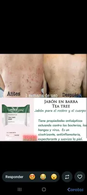 salud y belleza - jabones turcos  vaganos libre de paravenos y metales pesados  5