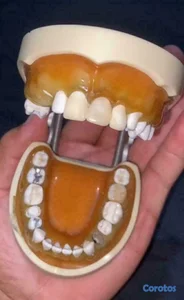 Dentoformo nissin